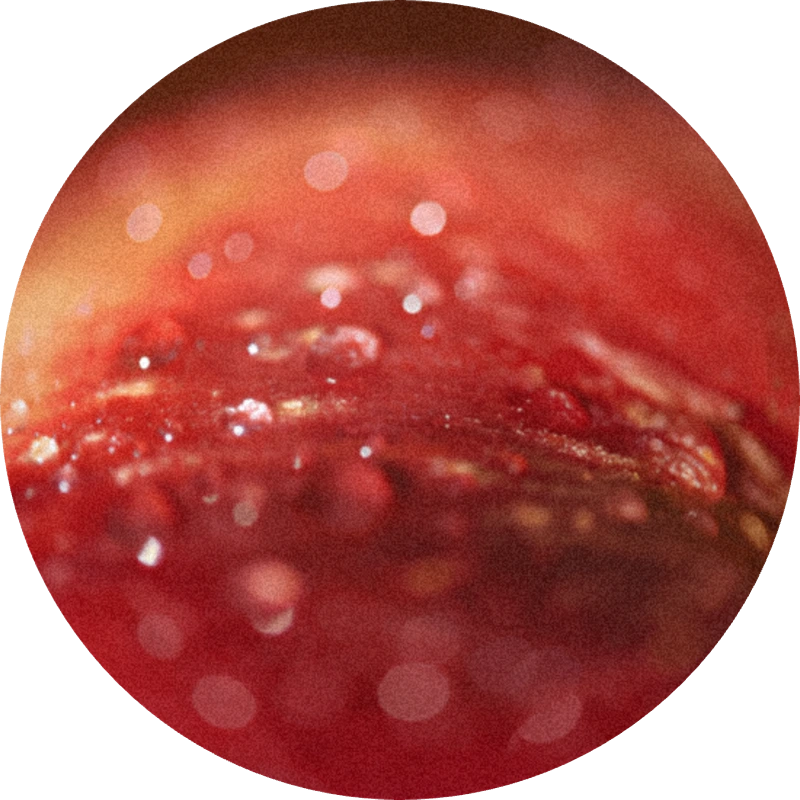 Manzanate