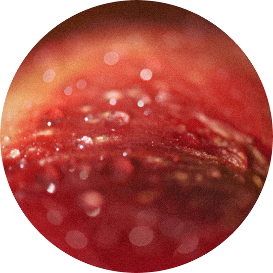 Manzanate